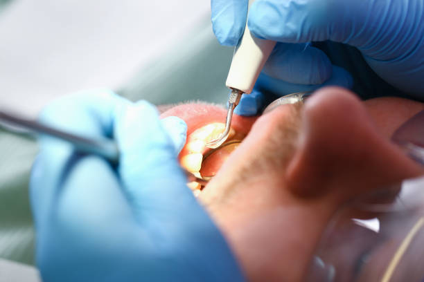 Best Orthodontic Emergency Dentist in Garden Ridge, TX