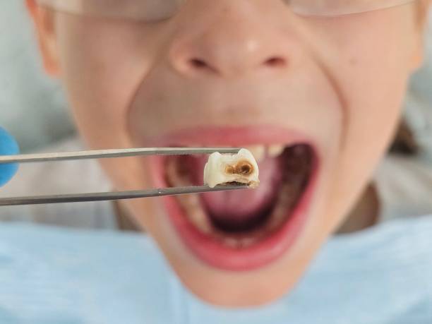 Best Pediatric Emergency Dentist in Garden Ridge, TX