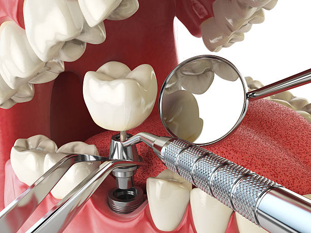 Best Emergency Dental Services for Seniors in Garden Ridge, TX